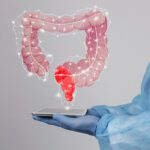 GI Alliance Supports Women’s Health Awareness Month: A Focus on Colorectal Health